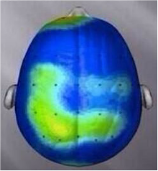 Brain after sitting quietly. Research/scan compliments of Dr. Charles Hillman University of Illinois.